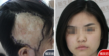 张女士