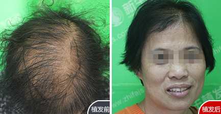 贺女士