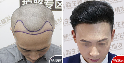 金先生