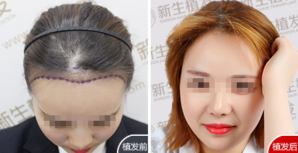 吴女士